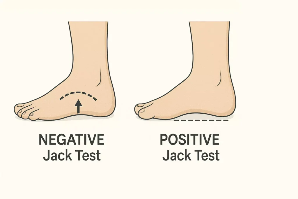 Comparison of negative Jack Test with arch elevation and positive Jack Test with persistent flatfoot